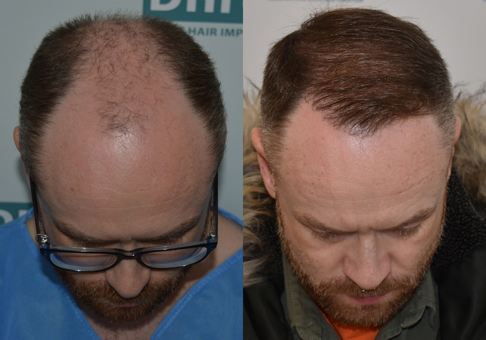 dhi thessaloniki griechenland