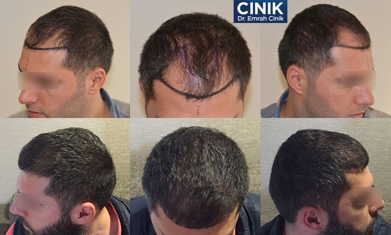 Dr Cinik Istanbul Turkei