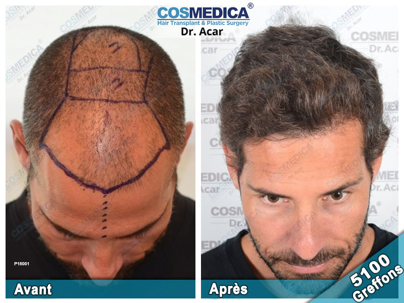 Cosmedica, Dr Acar, Istanbul, Turkey