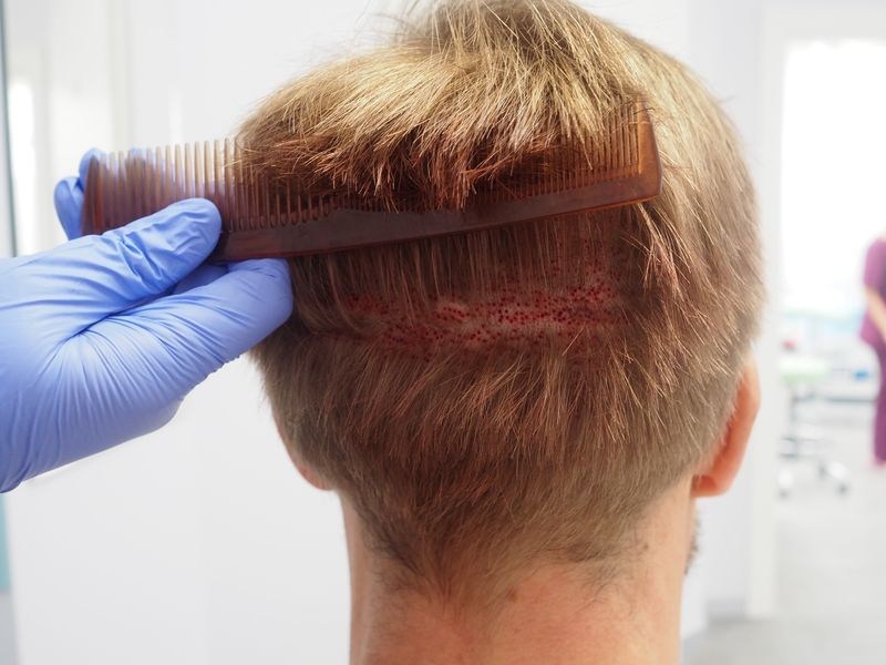 Medical Hair Warsaw Poland We respect your budget needs and your desire to have a. medical hair warsaw poland