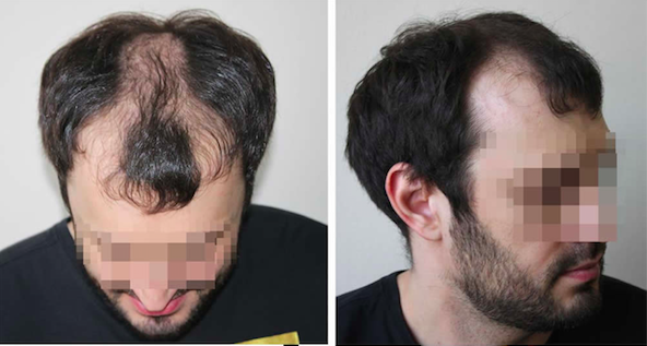 Browse results of hair transplant clinics in Europe